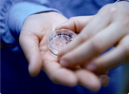 浅析移植5天囊胚的着床过程,共有游离、定位、植入三个步骤 囊胚移植后10天会发生着床现象