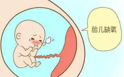 孕期胎儿缺氧怎么办？会影响智力吗？