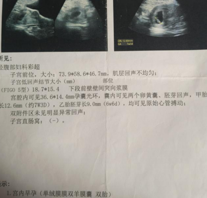 翻倍不好是胚胎质量差的原因吗？我的试管经历想说点大实话
