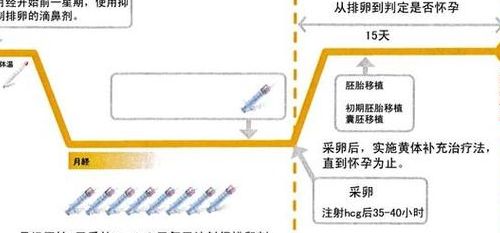 做试管什么样的人不需要降调？两类人能直接跳过这步