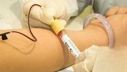 山大生殖三代试管大概多少钱一次？过来人帮你梳理真实费用明细
