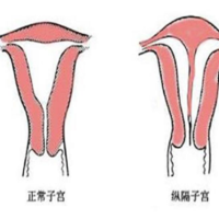 做试管代生要多少钱呢,山东生殖医院三代试管多少钱