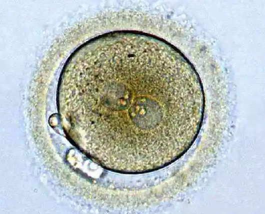 试管治疗过程中胚胎养囊失败是技术问题还是基因问题？