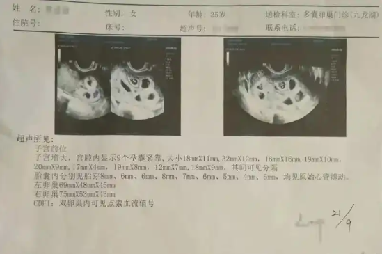 子宫动脉血流孕早期检查比较重要