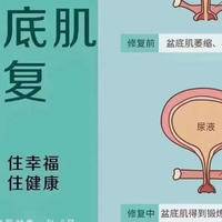 做盆底肌修复注意事项，科学恢复的实用指南