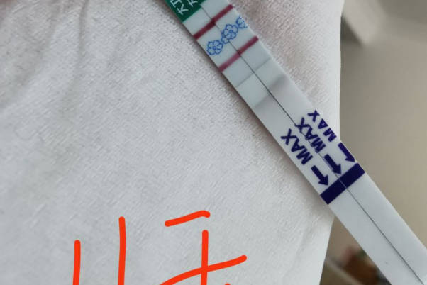 胚胎移植第十一天试纸呈现两条深线