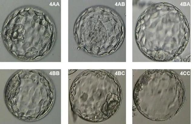 试管有8个胚胎可以养囊