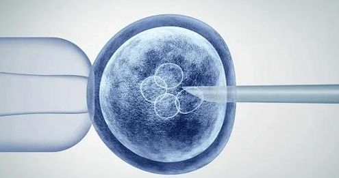 试管婴儿什么情况不用降调？这几种方案更适合你