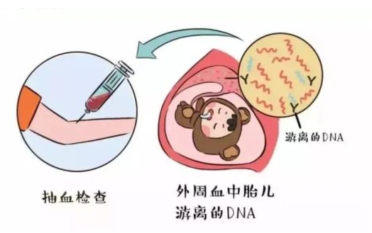 做无创不用强调试管婴儿