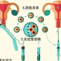 北京妇产医院试管婴儿过程：过来人帮你梳理5笔开销明细，一次花多少钱？
