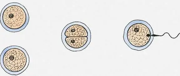 为什么囊胚容易变双胞胎