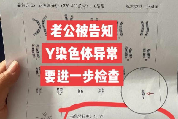 男方染色体异常的表现，具有多系统、多维度特征