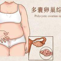 男人可以做试管生小孩吗？已婚和单身的答案截然不同