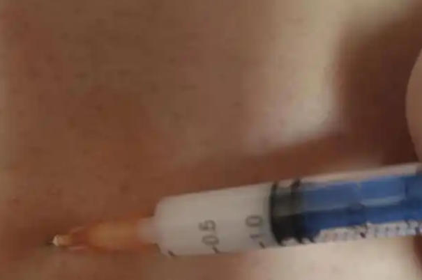 试管前打亮丙瑞林后有血丝是正常的