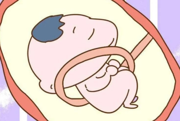脐带绕颈与胎儿性别无关