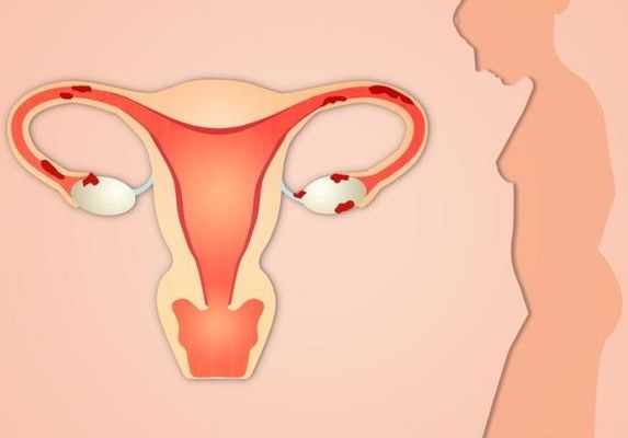 合肥高龄供卵试管多少钱？过来人帮你梳理6笔开销明细
