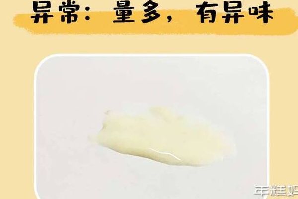 试管移植1-14天，内裤分泌物看怀孕征兆：熬到开奖全记录