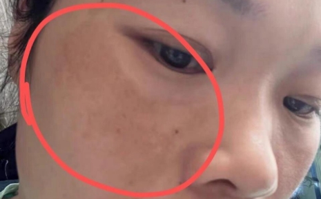 孕期皮肤暗沉别焦虑