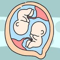 三孩政策后第三胎是双胞胎，政策解读与应对指南