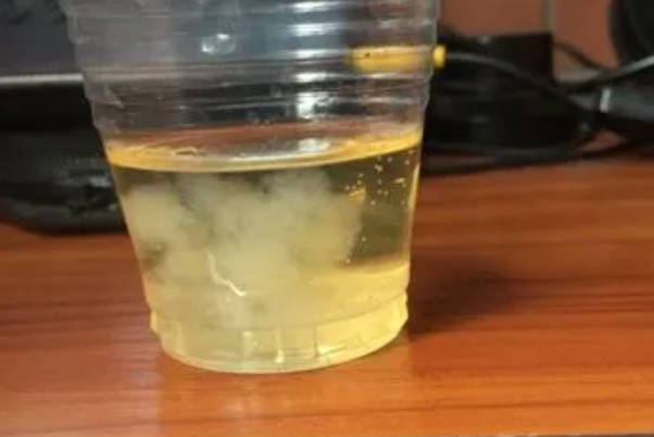 怎么用酒精测试自己怀上的是男孩还是女孩呢？