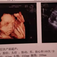 北京双胞胎代怀网,(北京妇产试管婴儿)北京供卵试管婴儿代怀生子医院排名前十公布