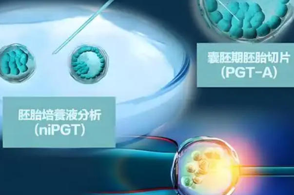 高龄女性可以做试管婴儿