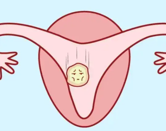 子宫内膜薄影响胚胎着床