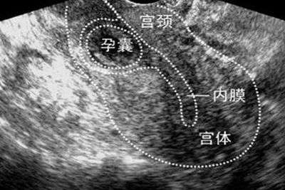 40岁的女人做试管婴儿成功率多少？表姐三次卵母细胞采集后说了实话