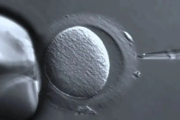 试管胚胎移植个数一般是一个