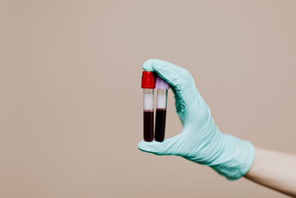 通过抽血可以判断降调是否标准