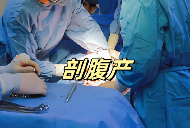 剖腹产顺便结扎