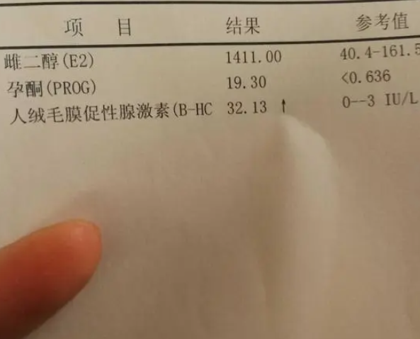 HCG用于判断是否怀孕