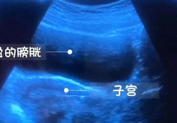 试管怎么做的_生殖咨询师拆解从检查到移植的3个步骤