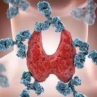 甲状腺右侧叶结节t2级影响试管吗?
