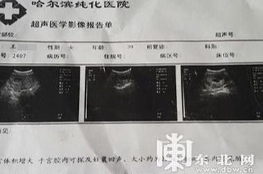 早孕多少天起保胎最好？4个判断维度帮你拿定主意