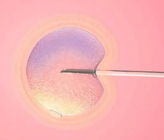 冻胚移植前要考虑多因素