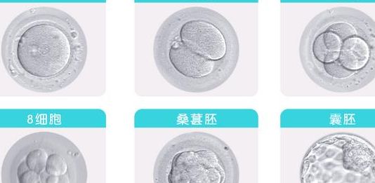 囊胚和胚胎的区别：移植选哪个？对比成功率与风险