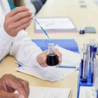 做肾功能5项检查多少钱，试管前为什么要检查肾功能