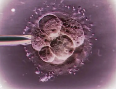 胚胎移植的时期有什么注意事项