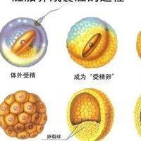 养囊胚不成功是不是卵泡质量差？别急着给卵子判死刑