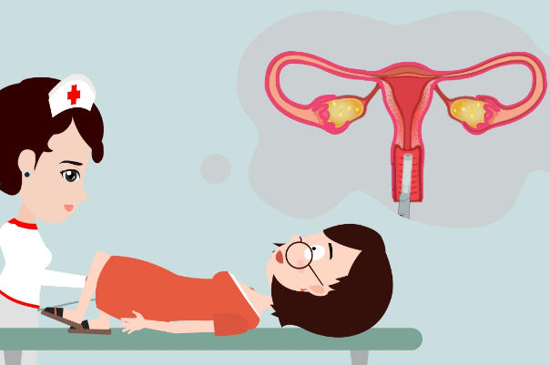 为什么医生一般不建议做阴超?解读临床选择背后的医学逻辑
