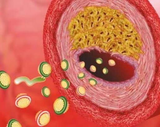 高密度胆固醇高影响试管结果