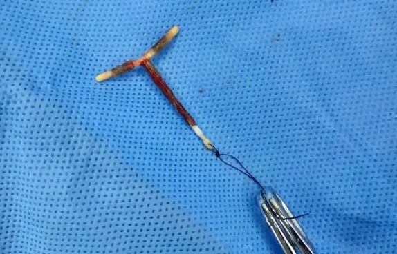 取环后需要休息的时间