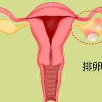 排卵障碍能做人工授精吗?主要还得看输卵管通不通