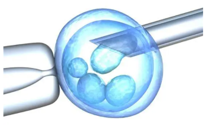 试管婴儿b级胚胎