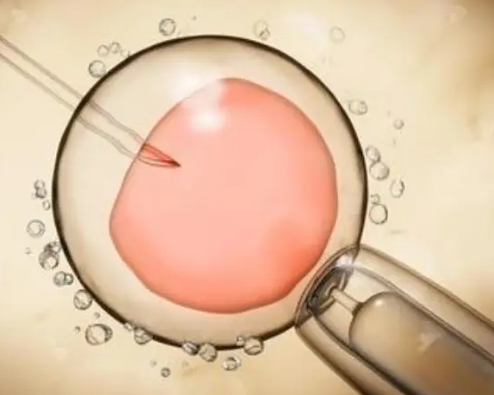 取卵3-5天后能移植胚胎