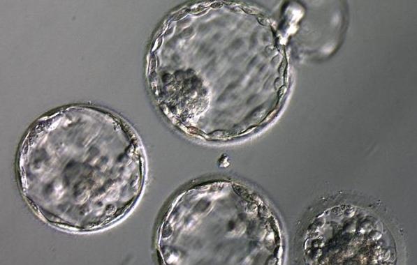 试管放几个胚胎最理想 试管放几个胚胎最理想