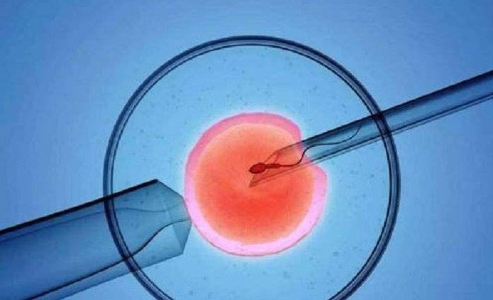 36岁人工授精成功经验
