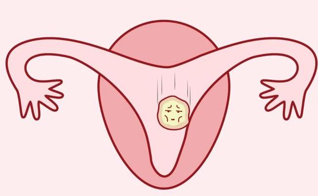 试管婴儿不用结婚证可以吗？2026年新规下这些条件你要清楚