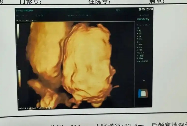 膝胸卧位法可以改变胎儿的位置